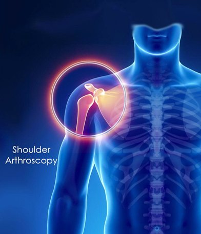 Orthopedic Instruments